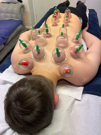 cupping salford, acupuncture salford, lgbt massage