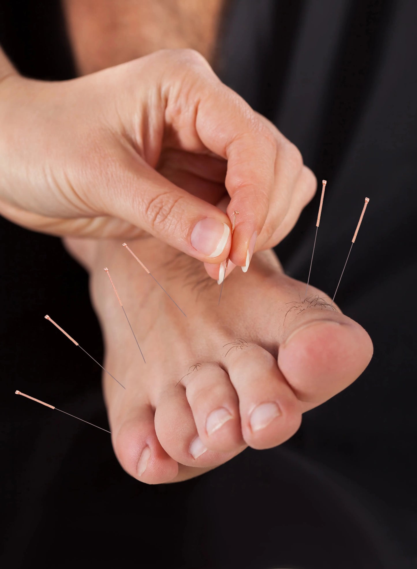 foot acupuncture, acupuncture salford